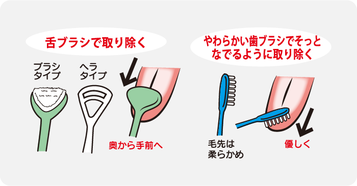 舌苔のケア方法