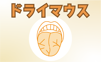 ドライマウス（口腔乾燥症）