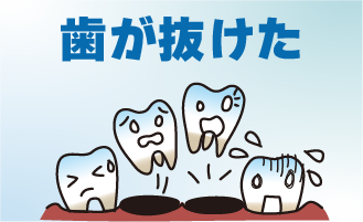 歯が抜けたときの対応