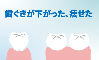 歯ぐきが下がった、痩せた