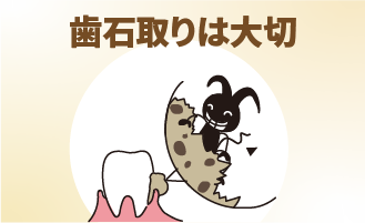 歯石取りは大切