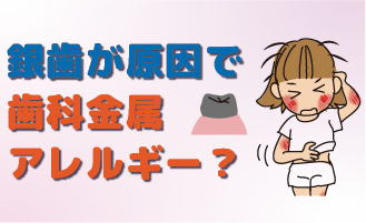 銀歯が原因で歯科金属アレルギー