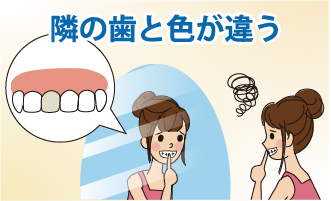 差し歯の変色・歯ぐきの黒ずみ